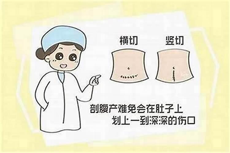 剖腹产八字准