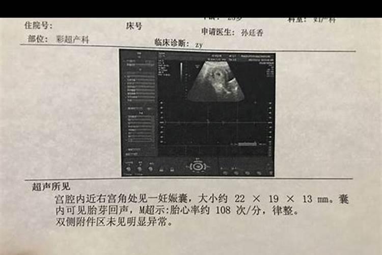 怀孕40天流产了需要清宫吗